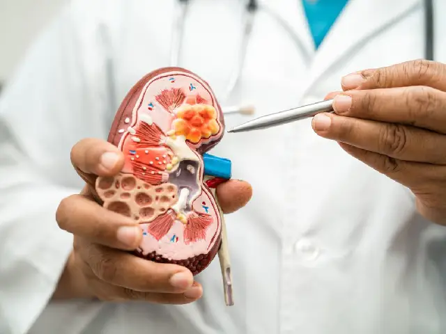 Symptoms of Kidney Cancer