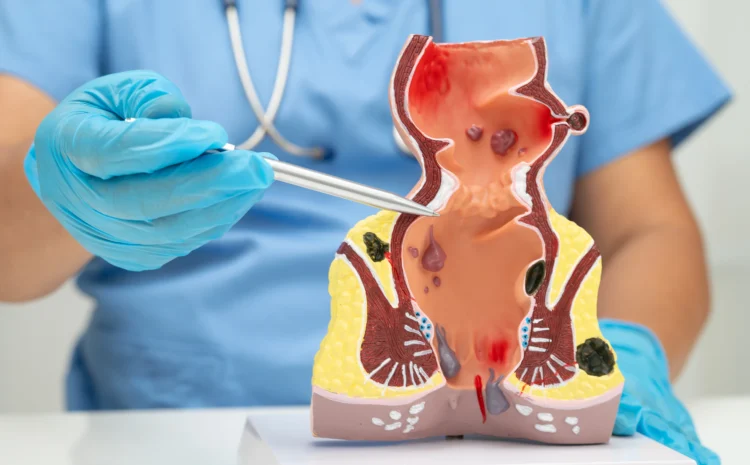  Bladder Cancer Treatment Options and When to Seek Medical Help