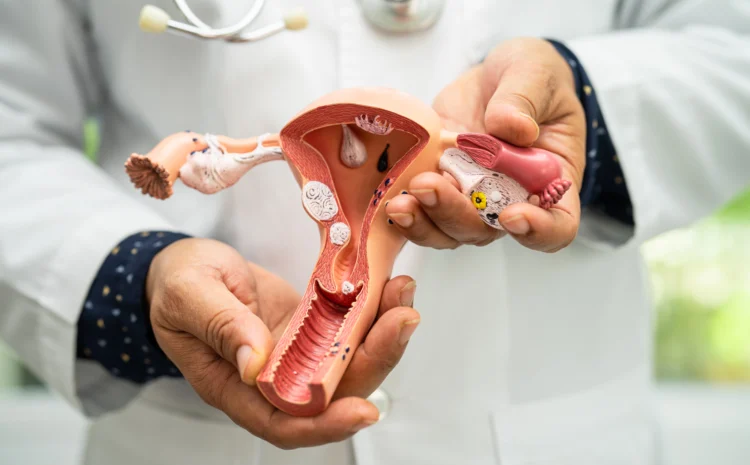 Ovarian Cancer Signs and Symptoms
