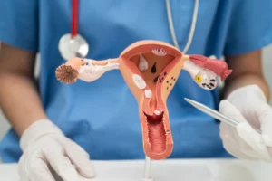 Ovarian Cancer Treatment Cost in Mumbai