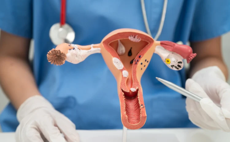  Ovarian Cancer Treatment Cost in Mumbai