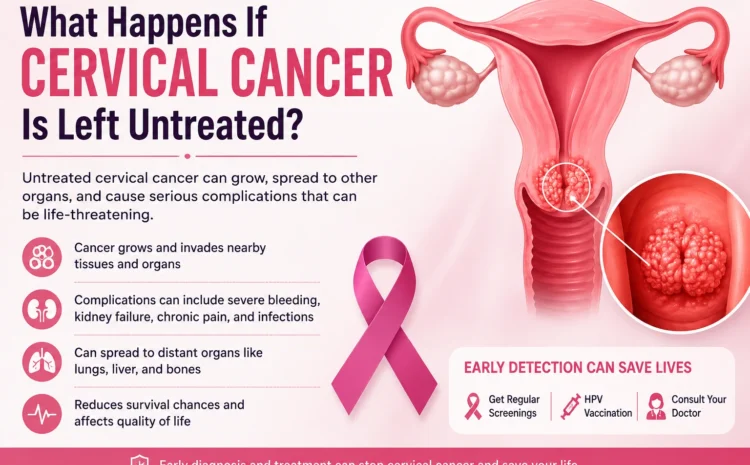  What Happens If Cervical Cancer Is Left Untreated?
