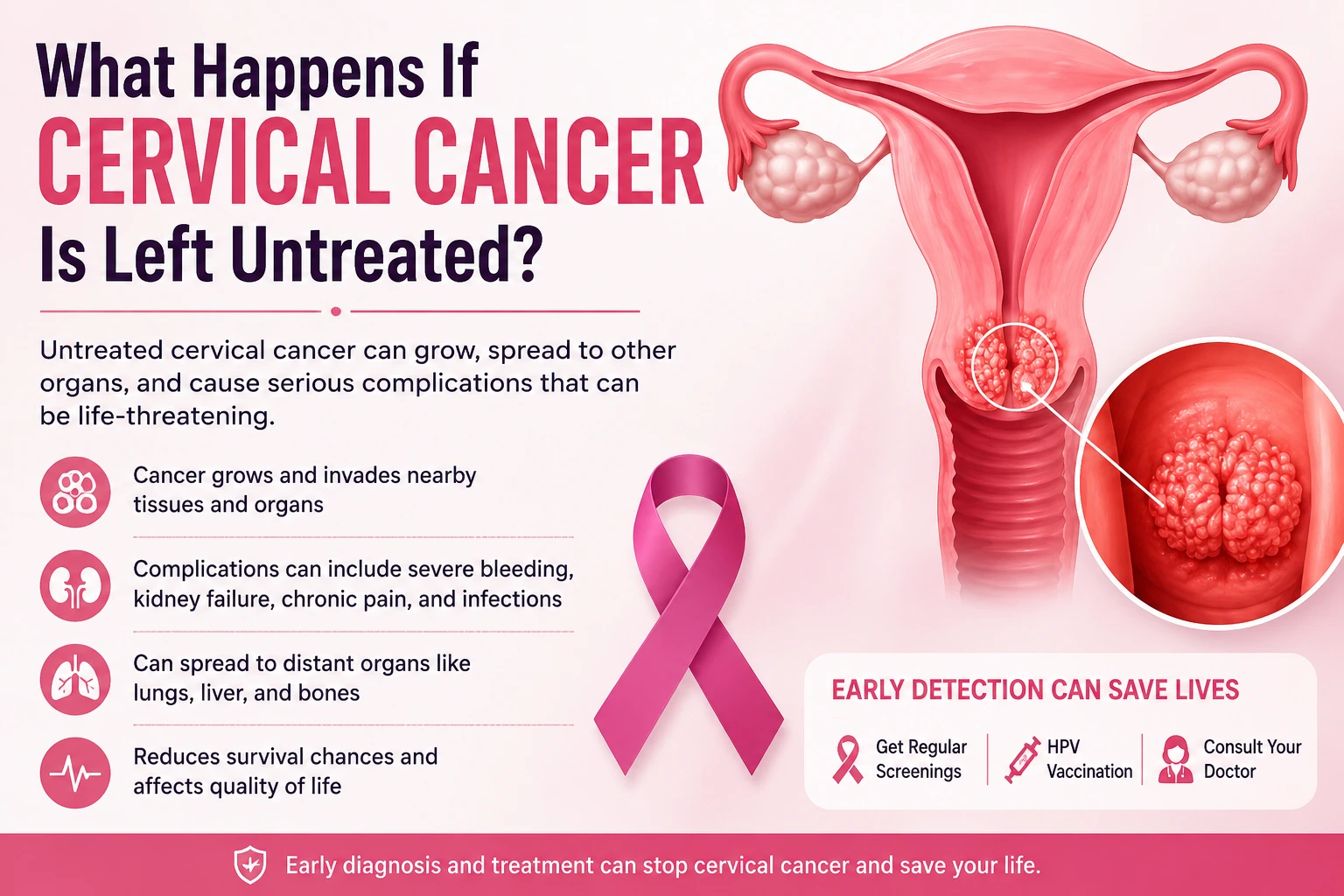 What Happens If Cervical Cancer Is Left Untreated