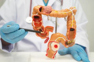 Colon Cancer vs Rectal Cancer: Treatment Differences