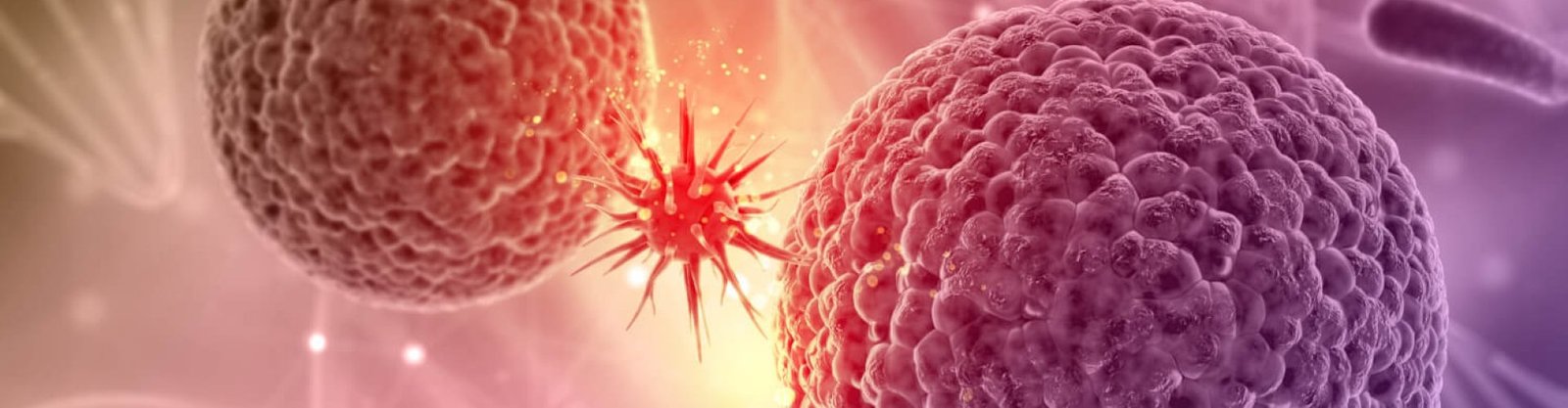 Sarcoma Cancer treatment in Mumbai