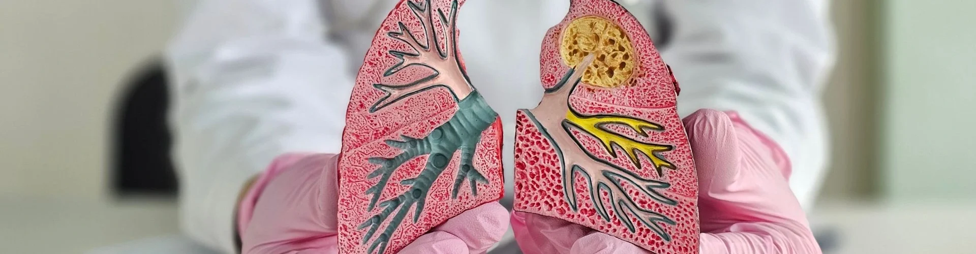 Lung Cancer Treatment in Mumbai